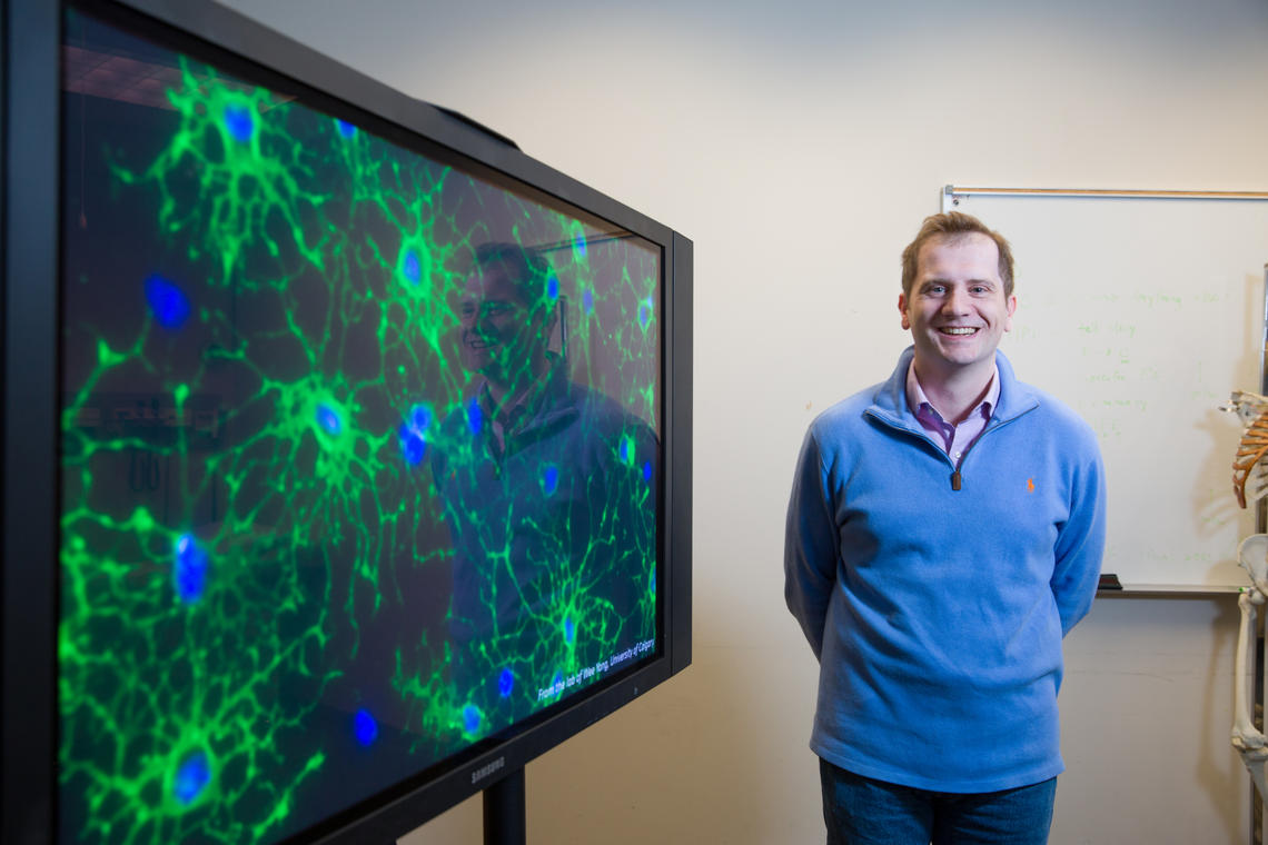 Marcus Koch leads a team of researchers from the Hotchkiss Brain Institute in a fresh approach to identifying drugs to fight the secondary progressive form of multiple sclerosis.