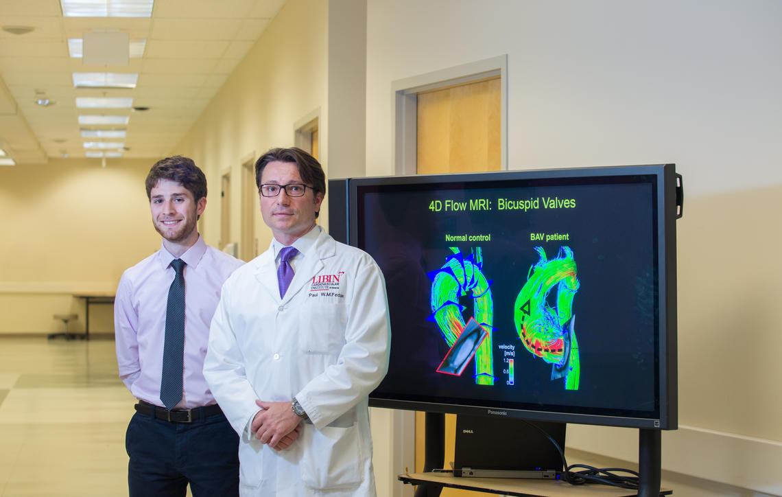 From left, David Guzzardi, PhD student and Dr. Paul Fedak, associate professor at the Cumming School of Medicine. Their new research study reveals that abnormal blood flow from bicuspid aortic valve disease can weaken the heart's aorta. Photo by Riley Brandt, University of Calgary 
