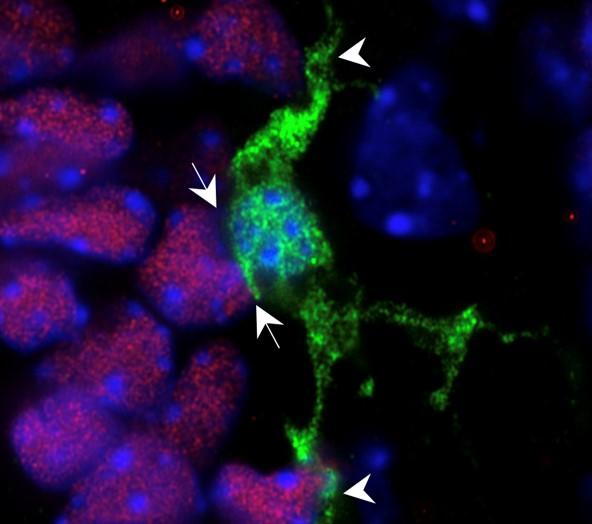 Microglia (green) in close contact with neural stem cells (pink)