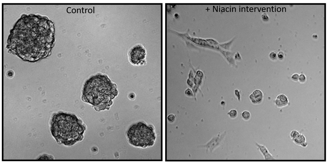 In tissue culture, glioblastoma patient-derived tumour stem cells grow robustly as clusters, with each cluster containing in excess of 100 cancer cells. When exposed to niacin-stimulated immune cells, the tumor cells are stopped in their tracks.