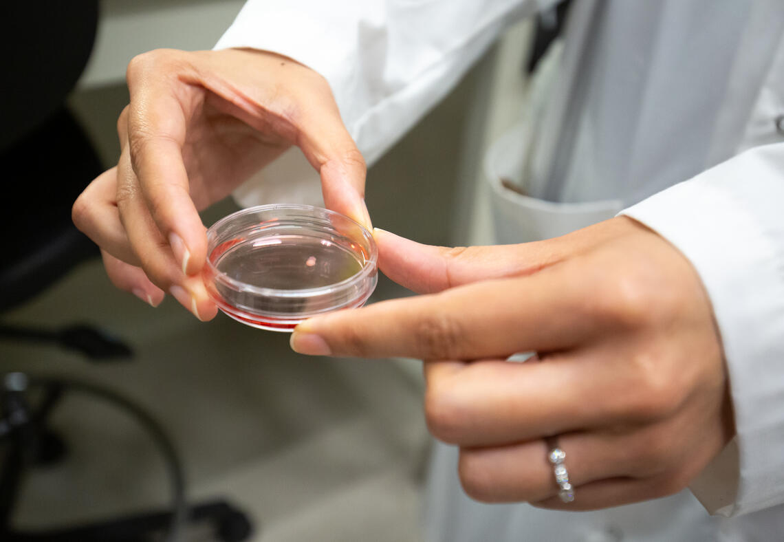Researcher holds petri dish containing cerebral organoid grown from Linden’s blood