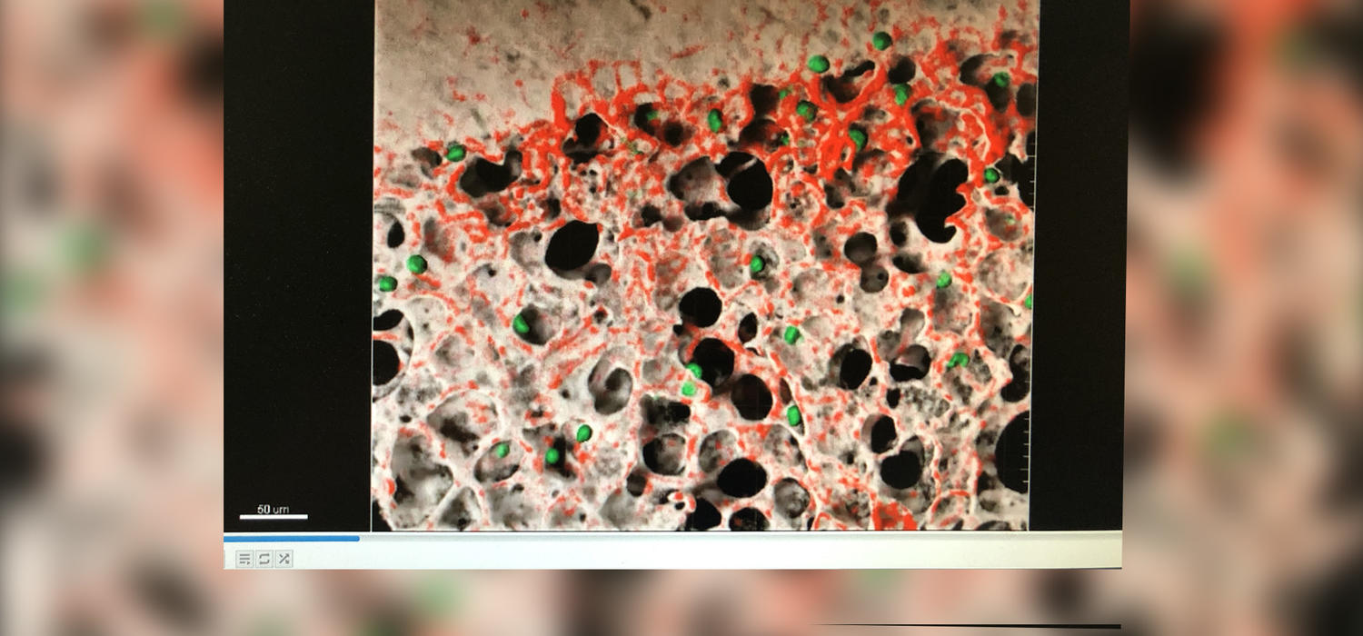 Kubes' lab at the University of Calgary discovered a way to take live images of immune cells at work inside the alveolar spaces in the lungs.